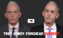 trey gowdy forehead surgery