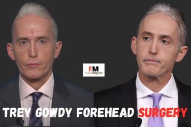 trey gowdy forehead surgery