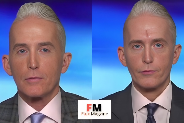 trey gowdy forehead surgery