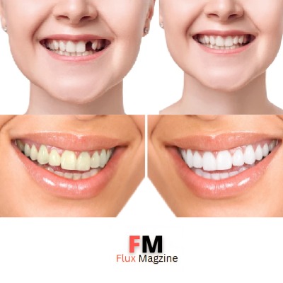 dental-implants-hungary-helvetic-clinics/